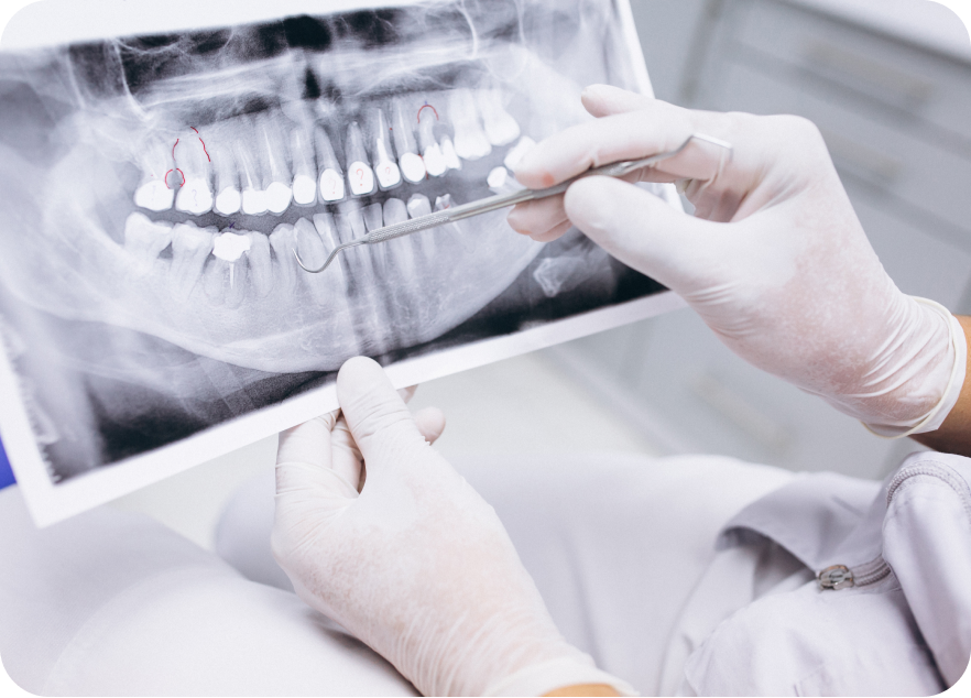 Escáner intraoral 3D en Montellano